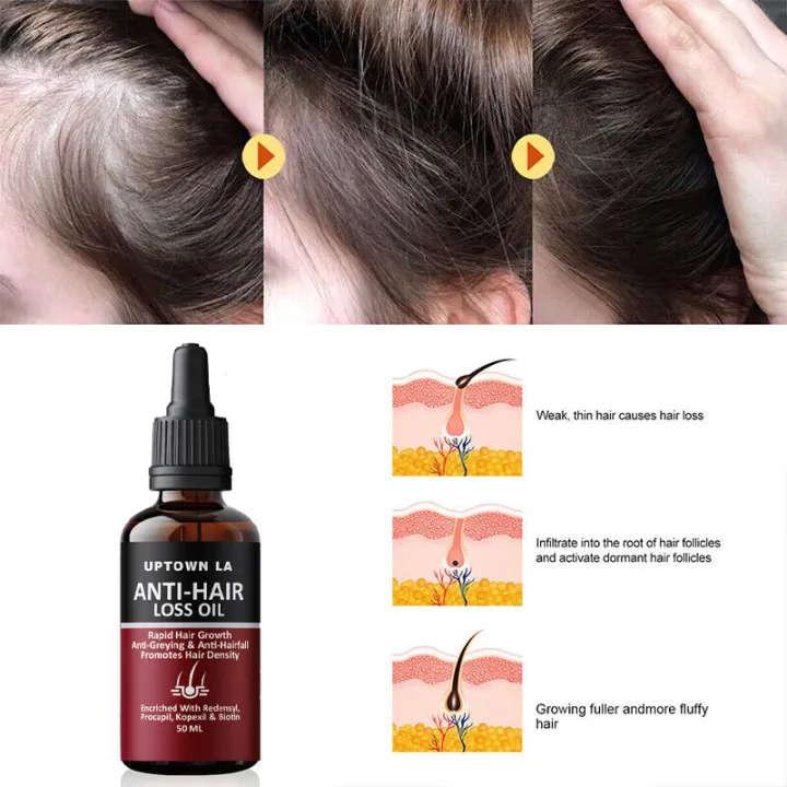 Uptown LA Anti Hair Loss Oil
