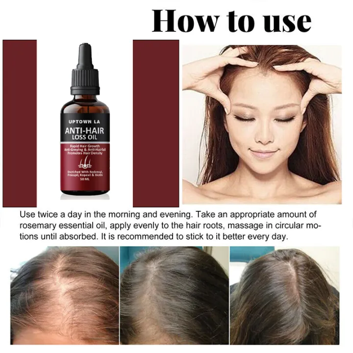 Uptown LA Anti Hair Loss Oil