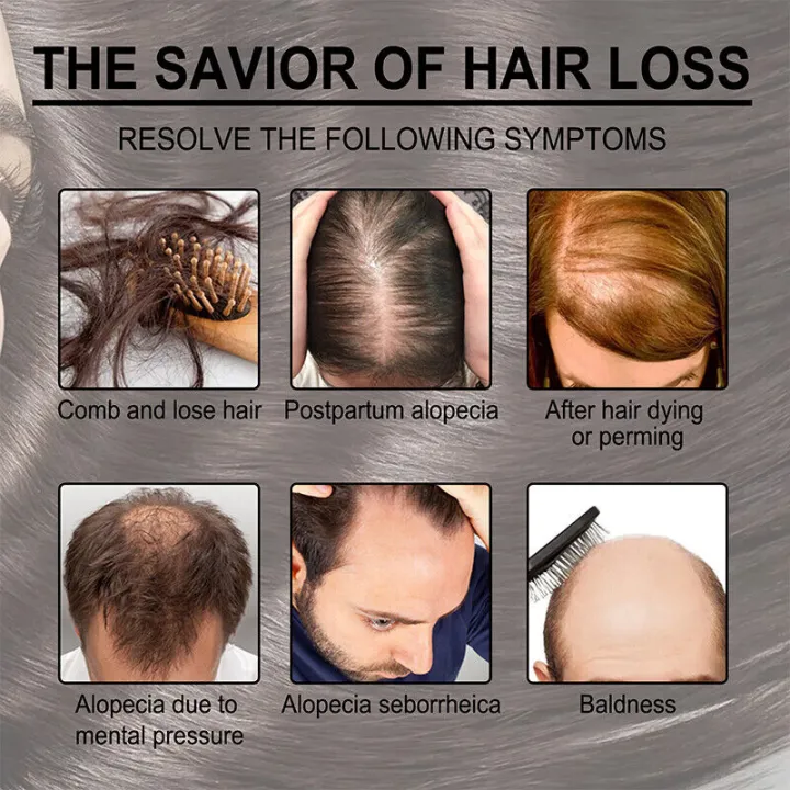Uptown LA Anti Hair Loss Oil